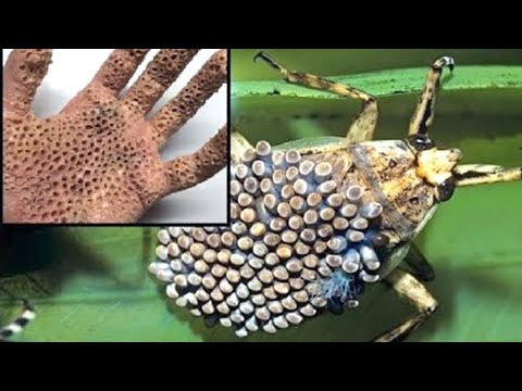 Vidéo: Choses qui mordent et piquent: méfiez-vous des insectes de l'été