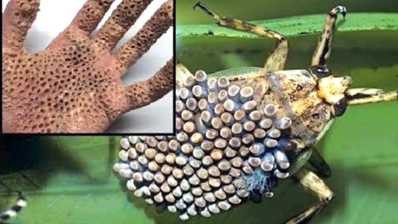 Les 15 Piqûres d'Animaux les plus Douloureuses que vous Pouvez