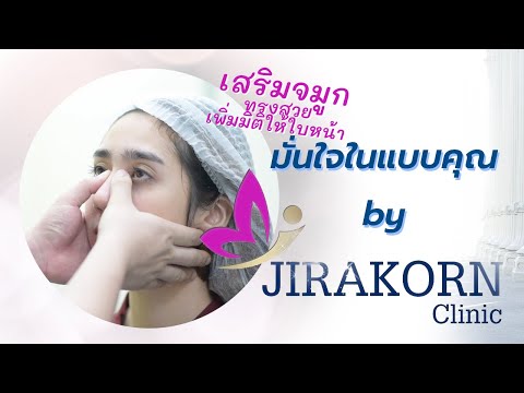 เสริมจมูก ทรงสวย เพิ่มมิติให้ใบหน้า l มั่นใจในแบบคุณ by จิรกร คลินิก