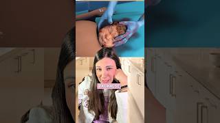 Qué ocurre en una cesárea: procedimiento, nacimiento y recuperación