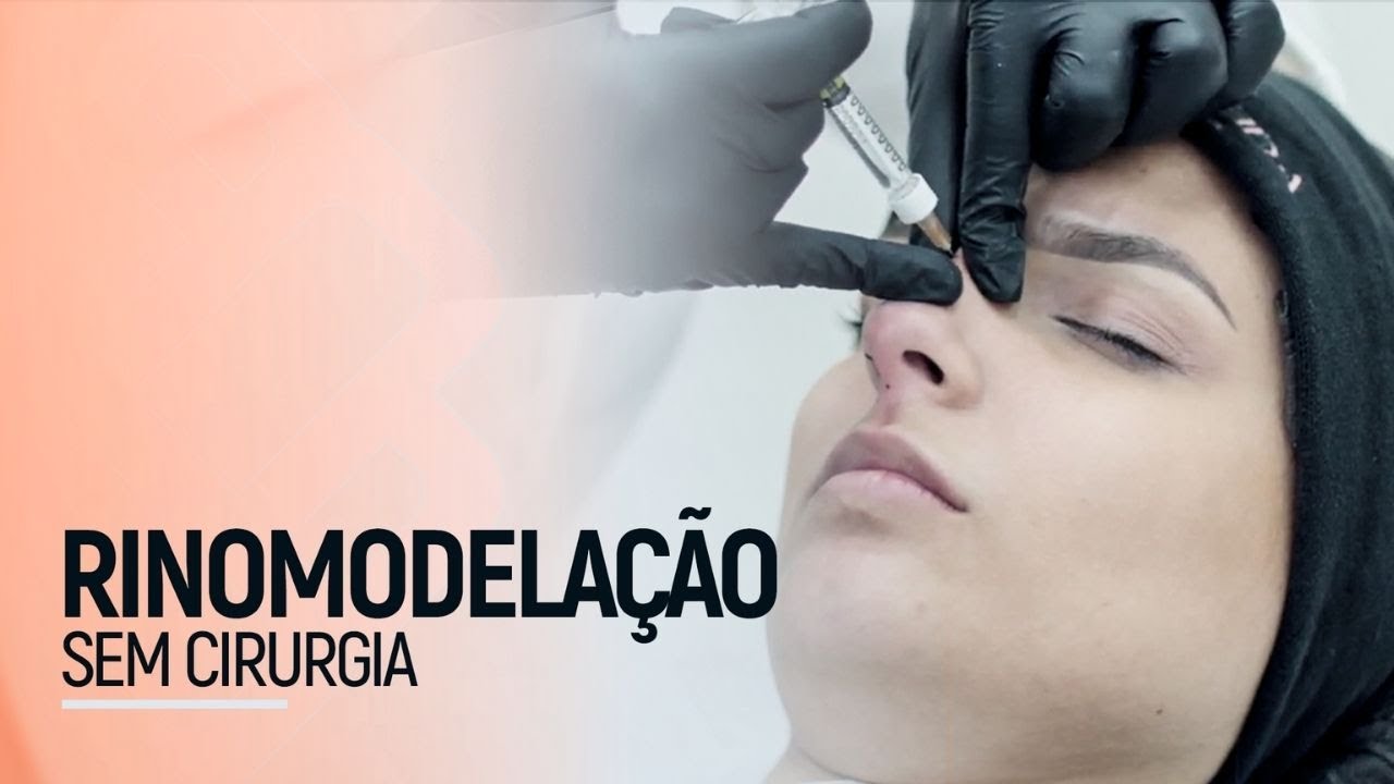Rinomodelação: o procedimento de modelação do nariz sem cirurgia