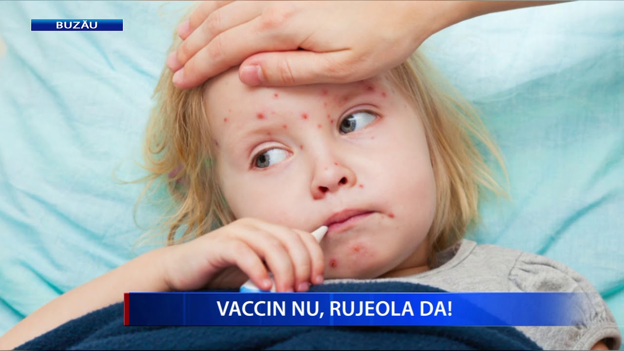 VACCIN NU, RUJEOLA DA camera iphone 8 plus apk