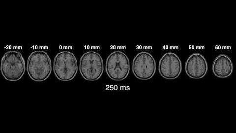 MEG-fMRI-behavior fusion