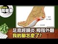 足底經膜炎.拇指外翻 我的腳怎麼了?【57健康同學會】第065集-2010年