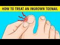 I Suffered From Ingrown Nails For Ages,  But This Cool Cure Saved Me