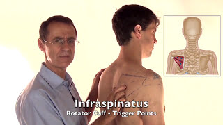 Trigger Point Release - Infraspinatus Muscle screenshot 3