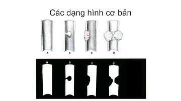 X quang ống tiêu hóa cản quang 2020