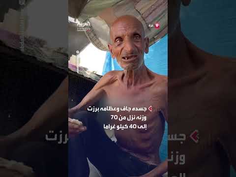معاناة يمنية: مواطن يتحدث عن صعوبة الحصول على الغذاء
