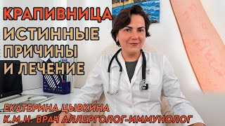 видео: Крапивница, настоящие причины и лечение. Врач аллерголог иммунолог Екатерина Цывкина. картинка: Крапивница, настоящие причины и лечение. Врач аллерголог иммунолог Екатерина Цывкина.
