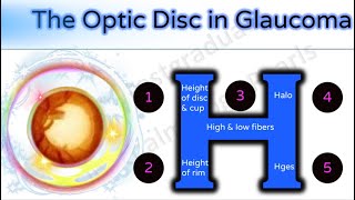 The Optic Disc in Glaucoma