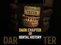 Waterloo Teeth: The Darkest Secret in Dental History #facts #learningengine