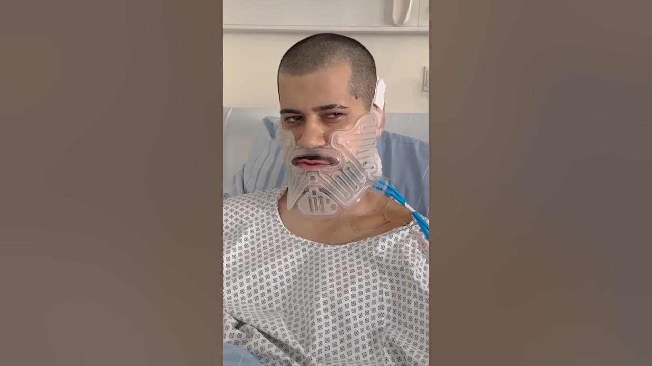 HamedLoco über seinen gebrochenen Kiefer 😱 YouTube
