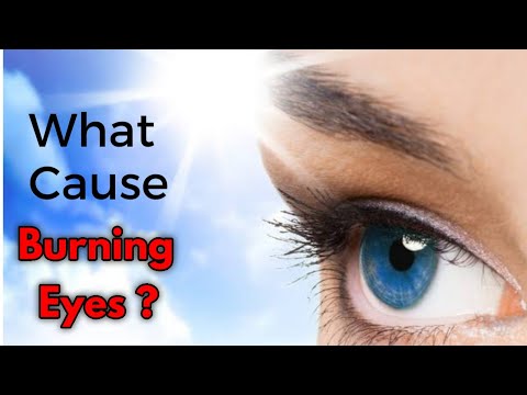 Burning Eyes ! Symptoms, Causes, Solution