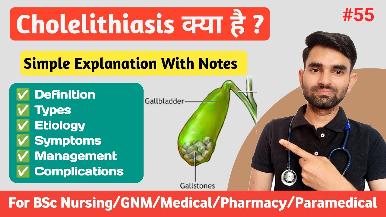 Cholelithiasis in Hindi | Types, Causes, Symptoms And Management of Cholelithiasis | Gallstones