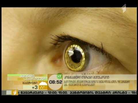 კონტაქტური ლინზები ტელესკოპით