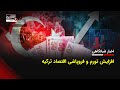 تورم و فروپاشی اقتصاد ترکیه جزئیات در اخبار شبانگاهی تورم و فروپاشی اقتصاد ترکیه جزئیات در اخبار شبانگاهی