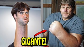 🔴 6 Pessoas que tem partes do corpo ANORMALMENTE Grandes!!