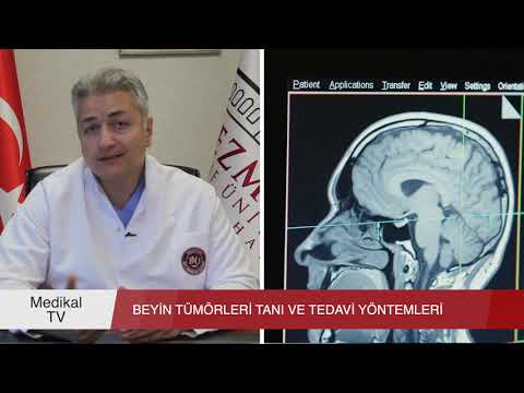 Video: Beyin Tümörünü Tespit Etmenin Basit Yolları (Resimlerle)