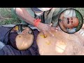 HIGHLY RECOMMENDED ASMR || BELLY BUTTON MASSAGE THERAPY FOR 24/ HOUR SLEEP!