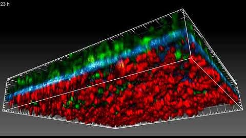 Cooperation of CAFs and cancer cells in basement membrane invasion by Alexandros Glentis