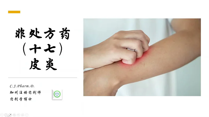 醫痴說葯 -  非處方葯（十七），皮炎（濕疹） - 天天要聞