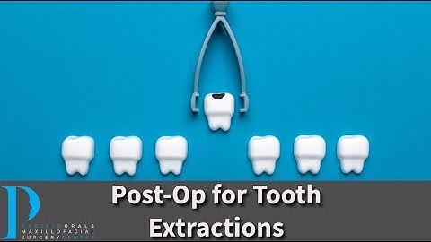 Tooth Extraction Post-Op Instructions