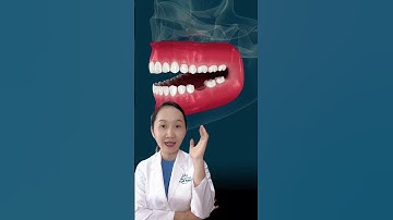 Bác sĩ ơi tại sao mất răng lại phải trồng răng? #shorts