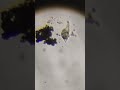 Lacrymaria olor: The Micro Predator with a Stretchable Neck 🦢🔬 #microscope #paramecium #microworld