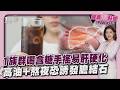 脂肪肝+糖尿病患者周喝1杯含糖手搖 肝硬化風險飆4倍！27歲女患膽結石誤以為胃炎20260519｜主播#王馨儀｜1700健康儀點靈 PODCAST｜TVBS新聞@TVBSNEWS01