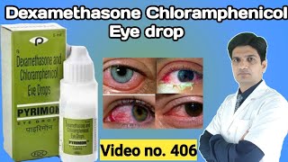 Dexamethasone and chloramphenicol eye drops | Pyrimon eye drop| Pyrimon drop | Renidex eye drop