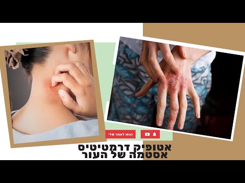 וִידֵאוֹ: האם מונח כללי מוגדר כדלקת של העור או פריחה שיכולות להיות סיבות רבות היא סימן להפרעות עור רבות?