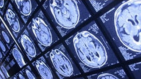Why IQ Tests Are Bunk