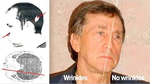 This Man Survived Putting His Head Inside A Particle Accelerator