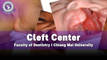 Cleft Center I Faculty of Dentistry I Chiang Mai University