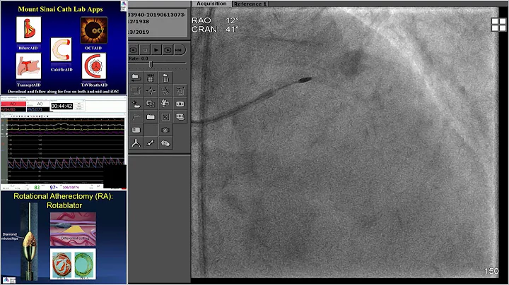 LC #3 - Unprotected LM PCI, Impella Assistance - CCC 2019