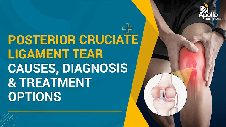 What is a Posterior Cruciate Ligament Tear? Its Causes, Symptoms, Diagnosis & Treatment Options