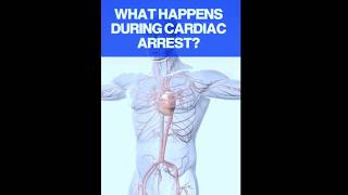 What Happens During Cardiac Arrest| mbbs | doctor| physiotherapy| anatomy| medical students #reels