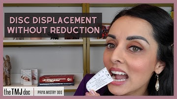 Disc Displacement Without Reduction - Priya Mistry, DDS (the TMJ doc) #articulardisc #jawlocked #tmd