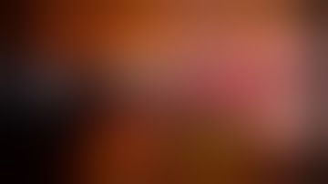 Total laparoscopic Hysterectomy Tips and Tricks