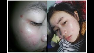 WOWWW😱 1 MINGGU PAKAI KF SKIN LC BEAUTY || NIGHT CREAM || LIDIYA GOMESSA