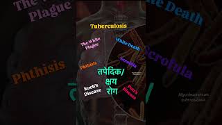 Different names of the Tuberculosis #nursingstudent #nursingeducation #medicalknowledge #explore