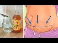 Drinking Apple Cider Vinegar Before Bedtime Will Change Your Life For Good