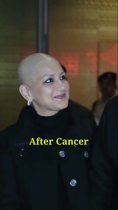 Sonali bendre before and after cancer😭🤤#shorts #viral #sonalibendre#cancerpatient #transformation