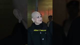 Sonali bendre before and after cancer😭🤤#shorts #viral #sonalibendre#cancerpatient #transformation