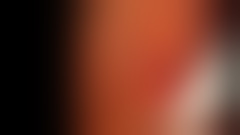 đặt stent metallic trong nội soi ERCP ( nội soi mật tụy ngược dòng)