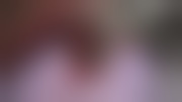 Physics Forceps Extraction of Decayed Roots on Lower Mouth 2 from GoldenDent, Atraumatic Extraction