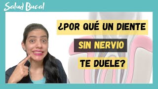 ¿Por que un diente sin nervio te duele?