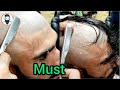 Head shave nizoral anti Dandruff shampoo razor bumps removal ni Attractive Dandruff Head 👈