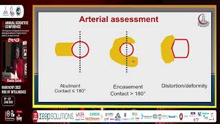 Radiological Imaging in Pancreatic Cancer Assessment