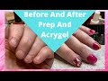 Short Bitten Nails Transformation | Acrygel Starter Kit | Beginners First Time Using A Polygel